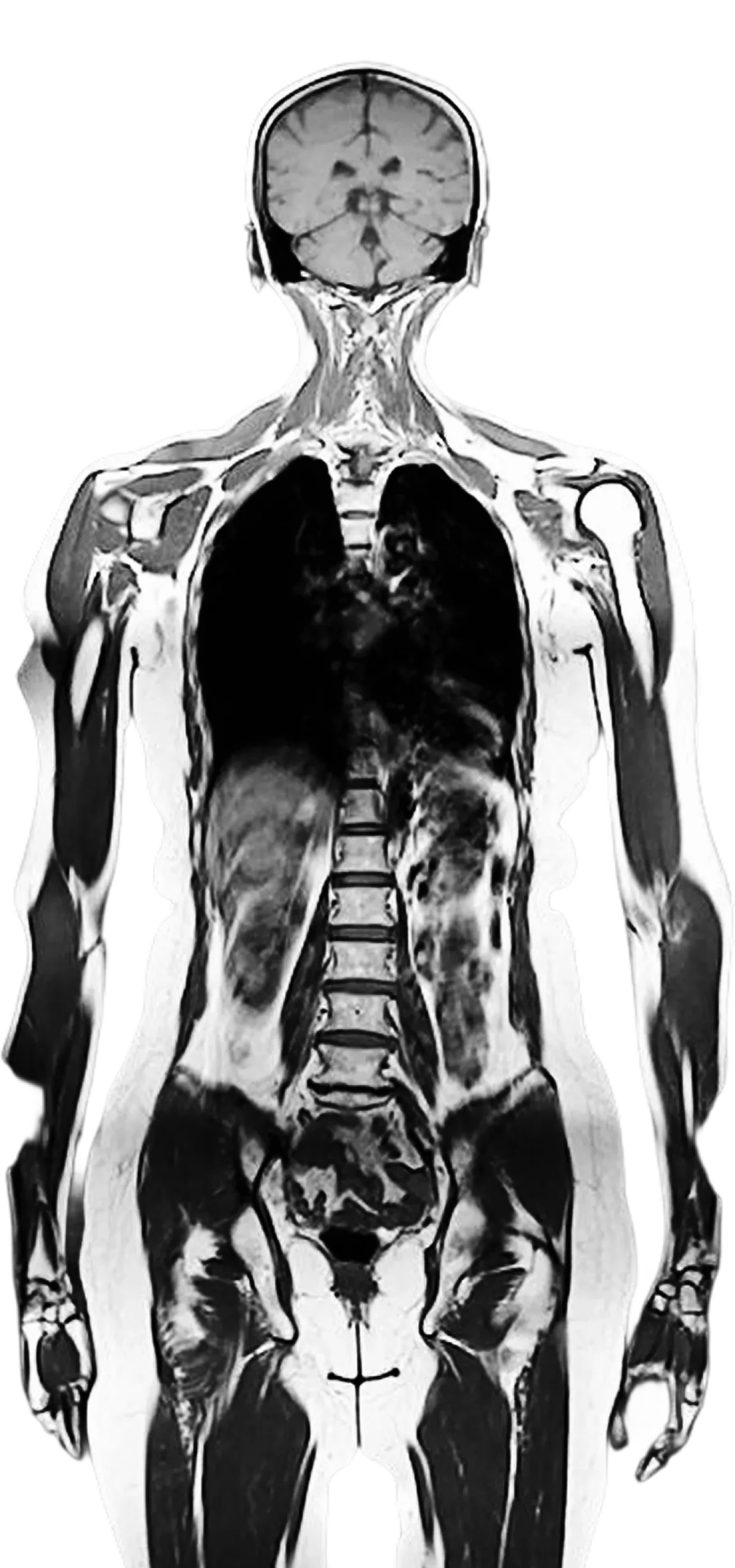 Anatomical diagram showing where each digital biomarker is measured on the body